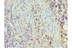 Immunohistochemistry (IHC) image for anti-Tumor Necrosis Factor (Ligand) Superfamily, Member 13b (TNFSF13B) (AA 76-285) antibody (ABIN7173805)