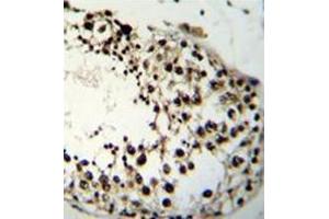 Immunohistochemistry analysis in formalin fixed and paraffin embedded human testis tissue reacted with LIN28A Antibody (Center) followed which was peroxidase conjugated to the secondary antibody and followed by DAB staining. (LIN28A antibody  (Middle Region))