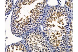 ABIN7095059 and ABIN7099115 at 1/100 staining mouse testis tissue by IHC-P.