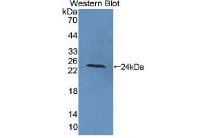 Figure. (PTPRA antibody  (AA 618-796))