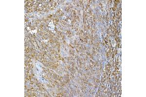 Immunohistochemistry of paraffin-embedded human tonsil using RPL13 Rabbit mAb (ABIN7269993) at dilution of 1:50 (40x lens). (RPL13 antibody)