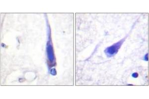 Immunohistochemistry analysis of paraffin-embedded human brain tissue, using Calmodulin (Ab-79/81) Antibody. (Calmodulin 1 antibody  (AA 46-95))