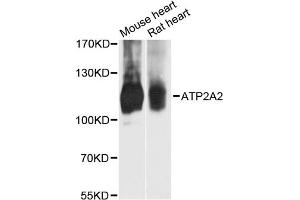 Western blot analysis of extracts of various cell lines, using ATP2A2 antibody. (ATP2A2 antibody)