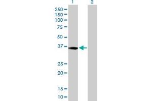 Western Blot analysis of XPA expression in transfected 293T cell line by XPA MaxPab polyclonal antibody. (XPA antibody  (AA 1-273))