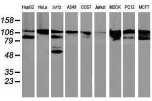 Image no. 6 for anti-Breast Cancer Anti-Estrogen Resistance 1 (BCAR1) antibody (ABIN1496832) (BCAR1 antibody)