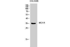 Western Blotting (WB) image for anti-Melanocortin 1 Receptor (MC1R) (C-Term) antibody (ABIN3185484) (MC1 Receptor antibody  (C-Term))