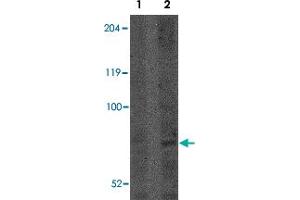 Western blot analysis of CNOT4 in A-549 lysate with CNOT4 polyclonal antibody  at (Lane 1) 1 and (Lane 2) 2 ug/mL .