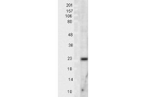 Western blot analysis of Rat Tissue lysates showing detection of SOD2 protein using Rabbit Anti-SOD2 Polyclonal Antibody .