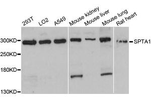 Western blot analysis of extracts of various cell lines, using SPTA1 antibody (ABIN6291367) at 1:3000 dilution.
