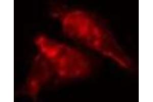 ABIN6277218 staining  HepG2 cells by IF/ICC. (EPB41 antibody  (Internal Region))