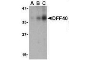 Immunocytochemical staining of DFF40 in K562 cells with DFF40 antibody at 10μg/ml. (DFFB antibody  (AA 203-218))