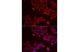 Immunofluorescence analysis of A549 cells using LGALS8 antibody.