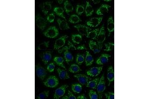 MTIF2 antibody  (AA 428-727)