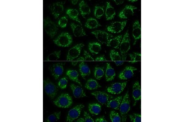 MTIF2 antibody  (AA 428-727)