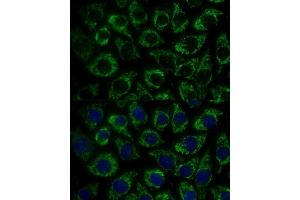 Immunofluorescence analysis of L929 cells using MTIF2 Polyclonal Antibody (ABIN7268591) at dilution of 1:100 (40x lens). (MTIF2 antibody  (AA 428-727))