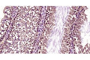 Paraformaldehyde-fixed, paraffin embedded Mouse testis; Antigen retrieval by boiling in sodium citrate buffer (pH6. (FBXO15 antibody  (AA 101-200))