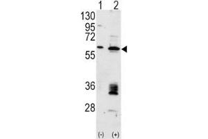 Western blot analysis of anti-MDM2 antibody and 293 cell lysate (2 ug/lane) either nontransfected (Lane 1) or transiently transfected with the MDM2 gene (2). (MDM2 antibody  (AA 393-424))