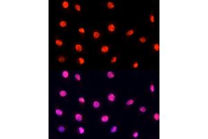 Immunofluorescence analysis of L929 cells using PRP19 antibody (ABIN6132438, ABIN6146256, ABIN6146258 and ABIN6216277) at dilution of 1:100 (40x lens).