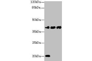 Western blot All lanes: STEAP1 antibody at 1 μg/mL Lane 1: U87 whole cell lysate Lane 2: A431 whole cell lysate Lane 3: A549 whole cell lysate Secondary Goat polyclonal to rabbit IgG at 1/10000 dilution Predicted band size: 40 kDa Observed band size: 40 kDa (STEAP1 antibody  (AA 3-69))