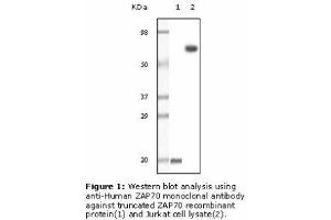 Image no. 2 for anti-zeta-Chain (TCR) Associated Protein Kinase 70kDa (ZAP70) antibody (ABIN207619)
