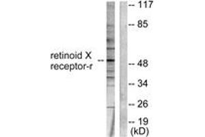Western Blotting (WB) image for anti-Retinoid X Receptor, gamma (RXRG) (AA 171-220) antibody (ABIN2889254) (Retinoid X Receptor gamma antibody  (AA 171-220))