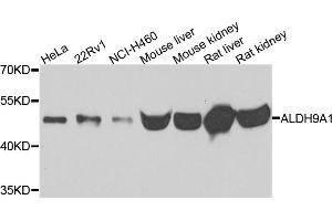 Western blot analysis of extracts of various cell lines, using ALDH9A1 antibody (ABIN5995392) at 1/500 dilution.