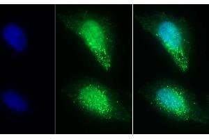 Detection of ST2 in Human U2OS cell using Polyclonal Antibody to Syntenin 2 (ST2) (SDCBP2 antibody  (AA 1-292))