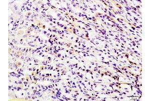 Immunohistochemistry (Paraffin-embedded Sections) (IHC (p)) image for anti-DEAD (Asp-Glu-Ala-Asp) Box Polypeptide 58 (DDX58) (AA 201-300) antibody (ABIN730663) (DDX58 antibody  (AA 201-300))