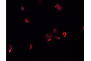 Immunofluorescence (fixed cells) (IF/ICC) image for anti-Sodium Channel, Nonvoltage-Gated 1, beta (SCNN1B) (C-Term) antibody (ABIN6264946)