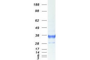 Validation with Western Blot (CD74 Protein (Transcript Variant 1) (Myc-DYKDDDDK Tag))