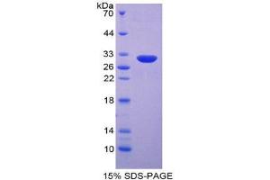 SDS-PAGE (SDS) image for Integrin beta 5 (ITGB5) (AA 137-378) protein (His tag) (ABIN2125340)