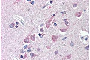 Human Brain, Cortex (formalin-fixed, paraffin-embedded) stained with FEM1B antibody ABIN214493 at 10 ug/ml followed by biotinylated goat anti-rabbit IgG secondary antibody ABIN481713, alkaline phosphatase-streptavidin and chromogen. (FEM1B antibody  (AA 609-622))