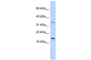 Leptin antibody used at 1 ug/ml to detect target protein.