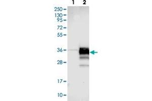 Western blot analysis of Lane 1: Negative control (vector only transfected HEK293T lysate). (STARD3NL antibody)