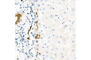 Immunohistochemistry (IHC) image for anti-Yes-Associated Protein 1 (YAP1) antibody (ABIN7271418)