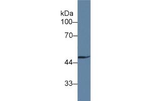 Detection of GAS6 in Rat Heart lysate using Polyclonal Antibody to Growth Arrest Specific Protein 6 (GAS6) (GAS6 antibody  (AA 503-664))