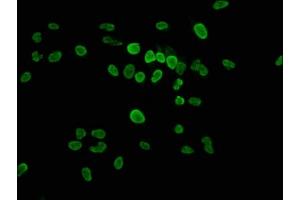 Immunofluorescence staining of Hela cells with ABIN7139625 at 1:2.