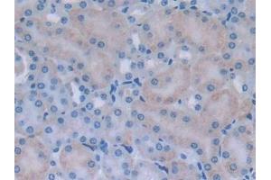 Detection of MYLK2 in Mouse Kidney Tissue using Polyclonal Antibody to Myosin Light Chain Kinase 2 (MYLK2) (MYLK2 antibody  (AA 330-548))