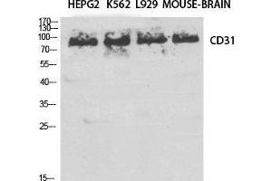 Western Blot (WB) analysis of specific cells using CD31 Polyclonal Antibody.