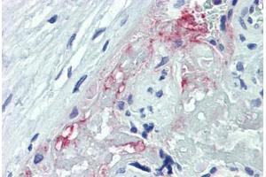 Human Placenta: Formalin-Fixed, Paraffin-Embedded (FFPE) (ADAM8 antibody  (AA 763-824))