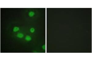 Immunofluorescence analysis of HepG2 cells, using SIX6 Antibody. (SIX Homeobox 6 antibody  (AA 121-170))