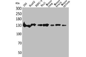 Western Blot analysis of 293 HepG2 BXPC-3 Raji mouse lung mouse brain mouse spleen cells using IL-16 Polyclonal Antibody (IL16 antibody  (C-Term))