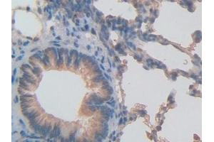 Detection of INHbB in Rat Lung Tissue using Polyclonal Antibody to Inhibin Beta B (INHbB) (INHBB antibody  (AA 297-411))