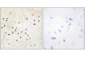 Immunohistochemistry analysis of paraffin-embedded human brain tissue, using TF2H1 Antibody. (GTF2H1 antibody  (AA 15-64))