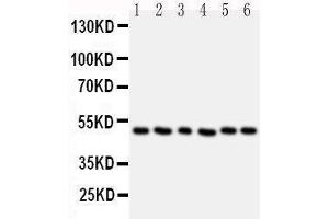Anti-HDAC3 antibody,  Western blotting Lane 1: Rat Stomach Tissue Lysate Lane 2: Rat Testis Tissue Lysate Lane 3: MCF-7 Cell Lysate Lane 4: HELA Cell Lysate Lane 5: JURKAT Cell Lysate Lane 6: SKOV Cell Lysate (HDAC3 antibody  (C-Term))