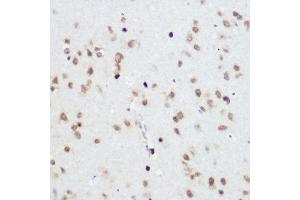 Immunohistochemistry of paraffin-embedded Rat brain using PLZF antibody (ABIN6128472, ABIN6150368, ABIN6150369 and ABIN6221570) at dilution of 1:200 (40x lens).