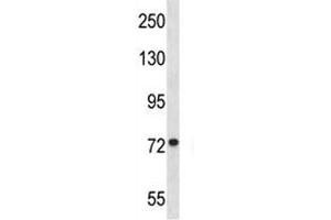 MFN1 antibody western blot analysis in Jurkat lysate. (MFN1 antibody  (AA 353-381))