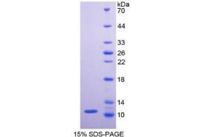 SDS-PAGE (SDS) image for Pyruvate Kinase M2 (PKM2) ELISA Kit (ABIN6574169)