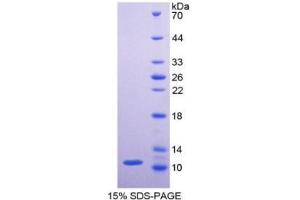 SDS-PAGE of Protein Standard from the Kit (Highly purified E. (PKM2 ELISA Kit)