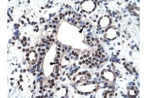 ZNF499 antibody was used for immunohistochemistry at a concentration of 4-8 ug/ml to stain Epithelial cells of collecting tubule (arrows) in Human Kidney. (ZBTB45 antibody  (Middle Region))